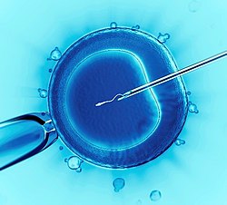 best infertility center in pakistan