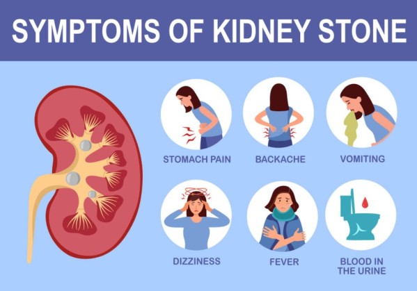 Kidney Stone Treatment